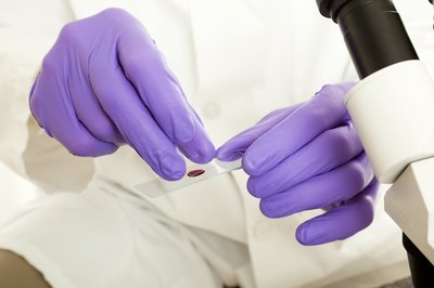 When an organ or muscles that contains CPK is damaged, the enzyme enters the bloodstream.