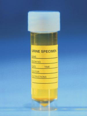 Stockbyte/Stockbyte/Getty Images Ultrasound-guided cystocentesis ensures quick, accurate and sterile urine sample collection.