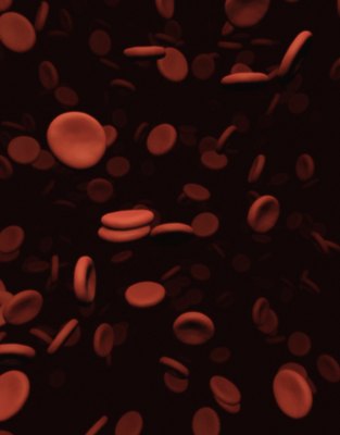 Chad Baker/Photodisc/Getty Images Rapid breakdown of red blood cells can cause big problems.