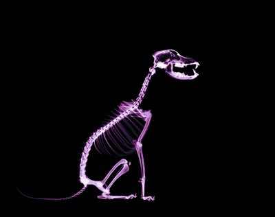Digital Vision./Digital Vision/Getty Images X-rays show the growth of bony spurs caused by spondylosis.