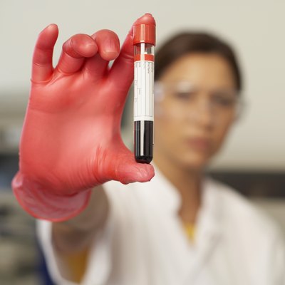Thinkstock Images/Comstock/Getty Images Albumin and globulin are proteins measured in general blood panels performed by your veterinarian.
