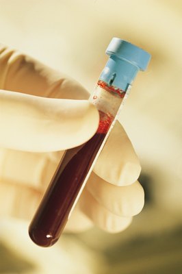 Comstock/Stockbyte/Getty Images Kidney function values are found in his blood and urine samples.