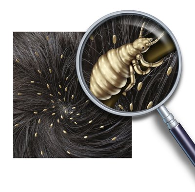 wildpixel/iStock/Getty Images Both human and canine lice eggs are called nits.
