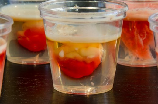 Brain Hemorrhage Shots