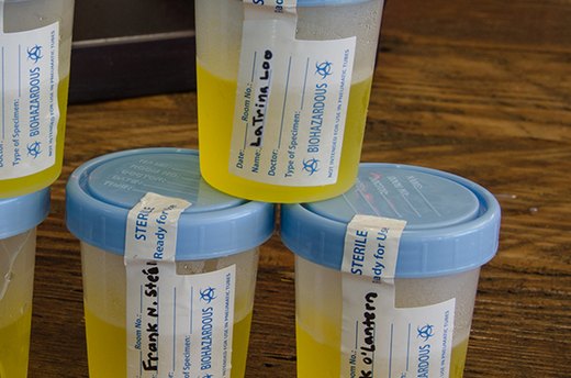Specimen Cups