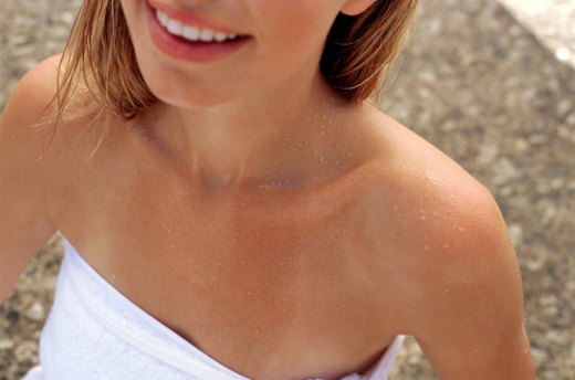 Don't burst sunburn blisters