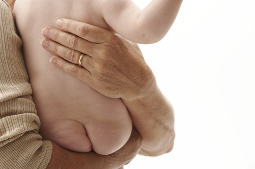 MYTH: Expose Diaper Rash to Sunlight