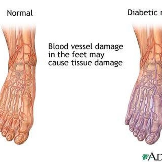 treatment for poor circulation in hands and feet