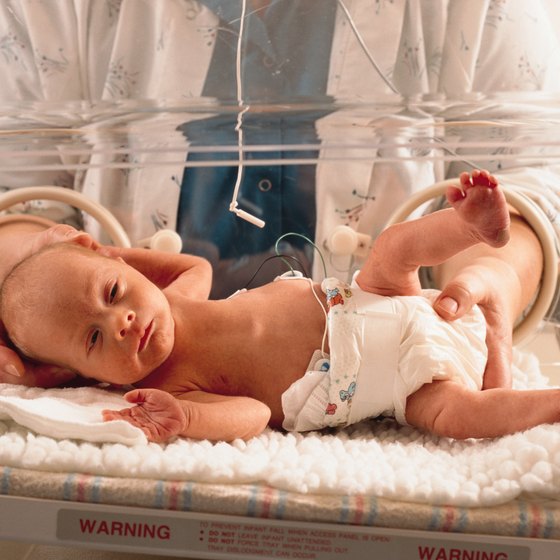 Premature babies may have health concerns.