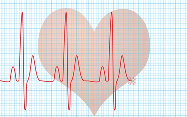 Cómo usar un aparato Holter