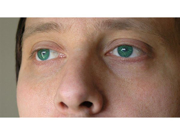 Healthy vision is important to a radiology tech's job effectiveness.