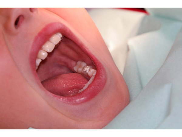 Surface area of teeth helps us chew our food