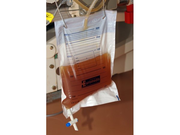 Renal System in PH Balance