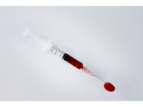 A rabies titer requires a blood sample from your dog.