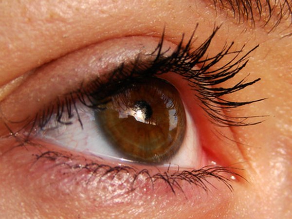 Inflammation can cause watering of the eyes and blurred vision.