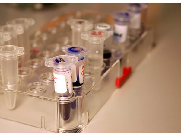 Testing for food allergies can help to pinpoint possible causes of tics.