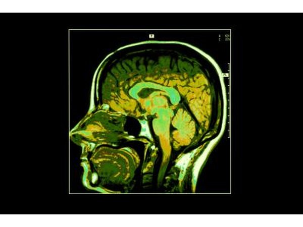 Cross section image of human brain