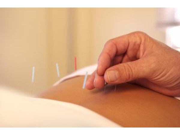 Acupuncture can help improve leg circulation.