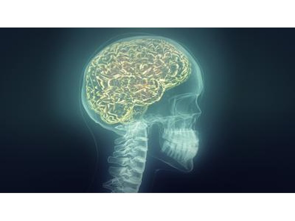 brain xray
