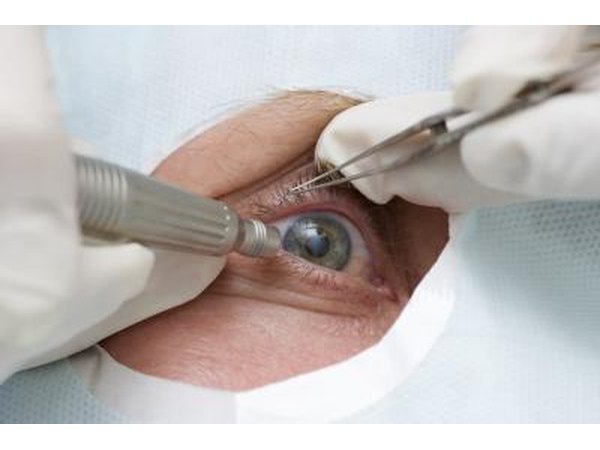 Treatment of an eye by ultrasound.