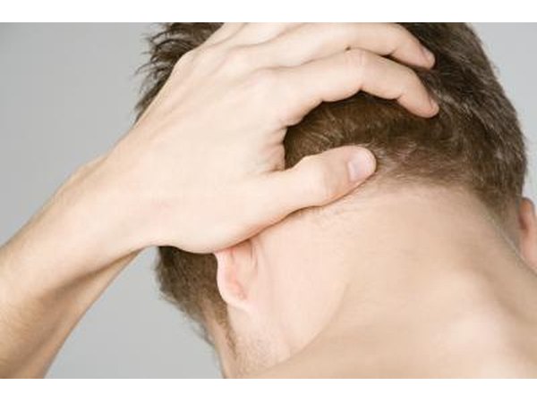 Notice skin reaction.