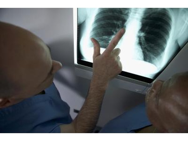 Chest X-ray