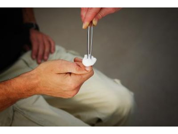 Vinegar can be applied full strength to the infected area.