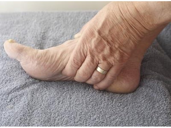Painful swelling seems to effect lupus patients.