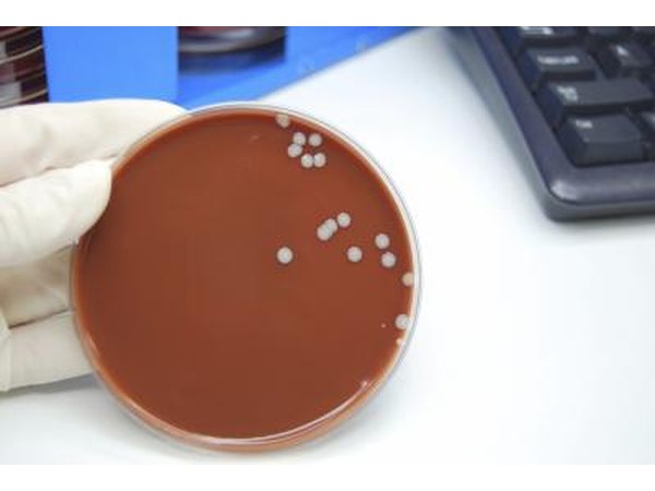 Microbiologist with staph infection.