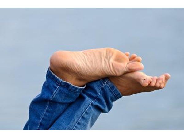 Bunions and callouses may form.