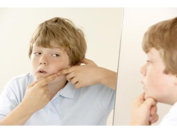 Tween boy touching pimple on face