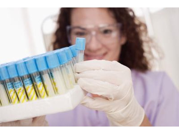 No fasting is required for hormone tests that test the levels of binding globulin, follicle stimulating or luteinizing hormone.