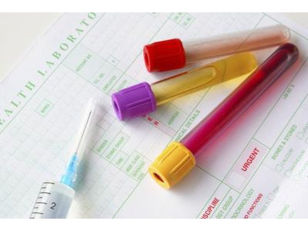 Consider getting a 24-hour urine test.
