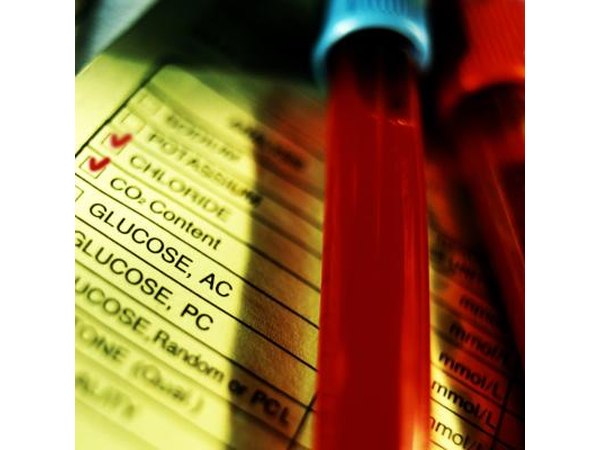Glucose levels next to a blood vial.
