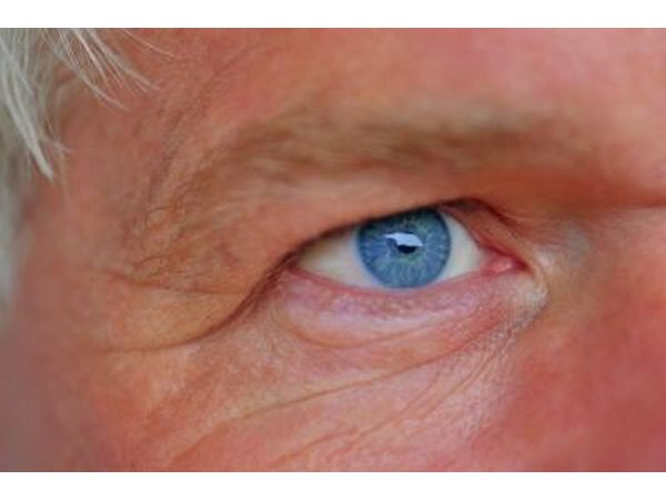 Senior eyes