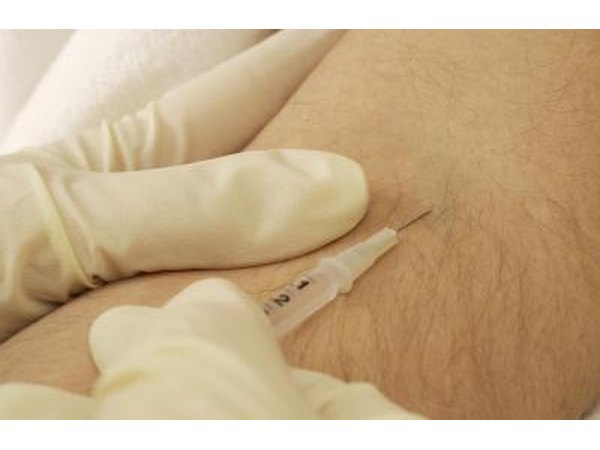 Cortisone