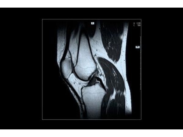 Joints of the knees and hips can become painful for people who do not eat enough.