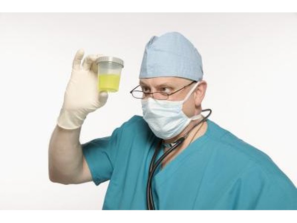 Doctor looking at urine specimen in cup.