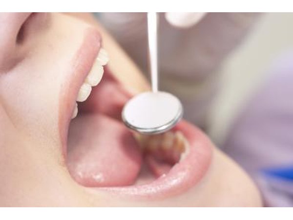 Dentist looking in patients mouth