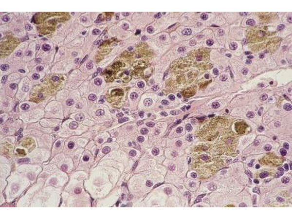 Magnified liver tissue.