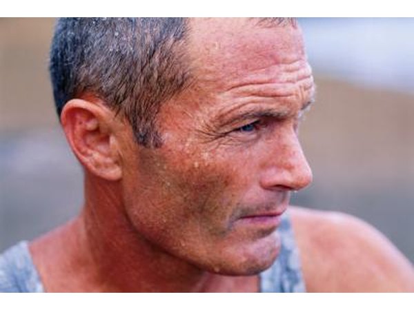 Sweating often accompanies gallstone pain