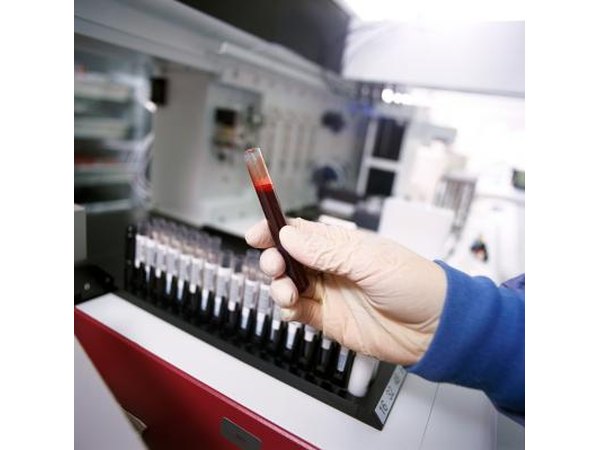 The test for estrogen is usually a blood test to determine levels of estradiol, estriol and estrone.