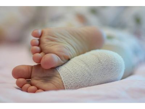 Woman getting resting after surgery