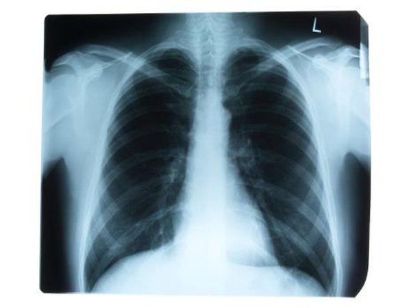 Ventilation problems in the lungs can lead to low oxygen levels in the blood especially if the alveoli in the lungs are not functioning properly.