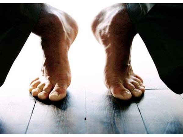 Flexible hammertoe can be corrected without surgery