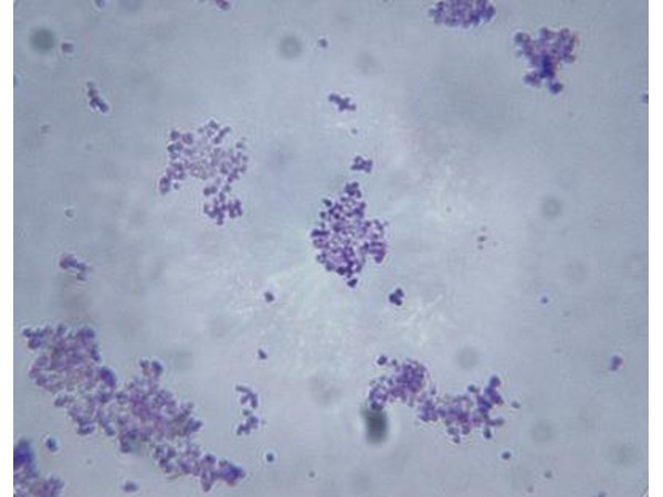Weather conditions and viral pathogens can cause lesions in spinach leaves.
