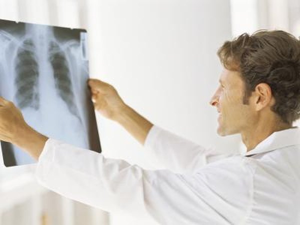 Doctor looking at an xray of the chest