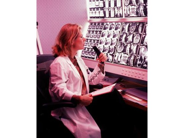 Doctor looking at MRI scans
