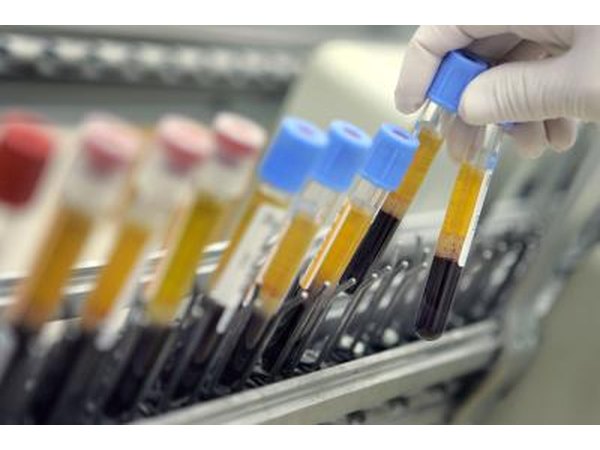 Human blood samples at testing center