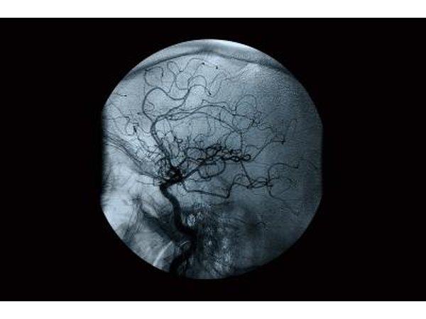 X-ray image of a circulatory system